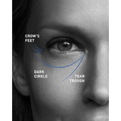 Fillmed Art Filler Eyes (2x1ml) - 6